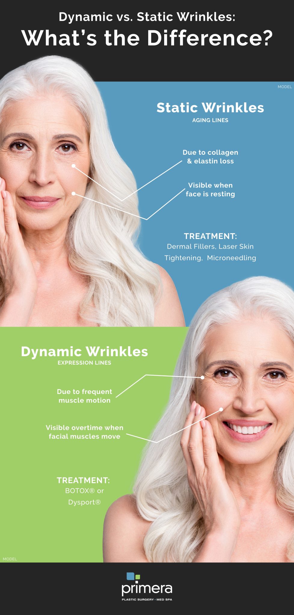 Dynamic vs. Static Wrinkles: What’s the Difference? (INFOGRAPHIC 